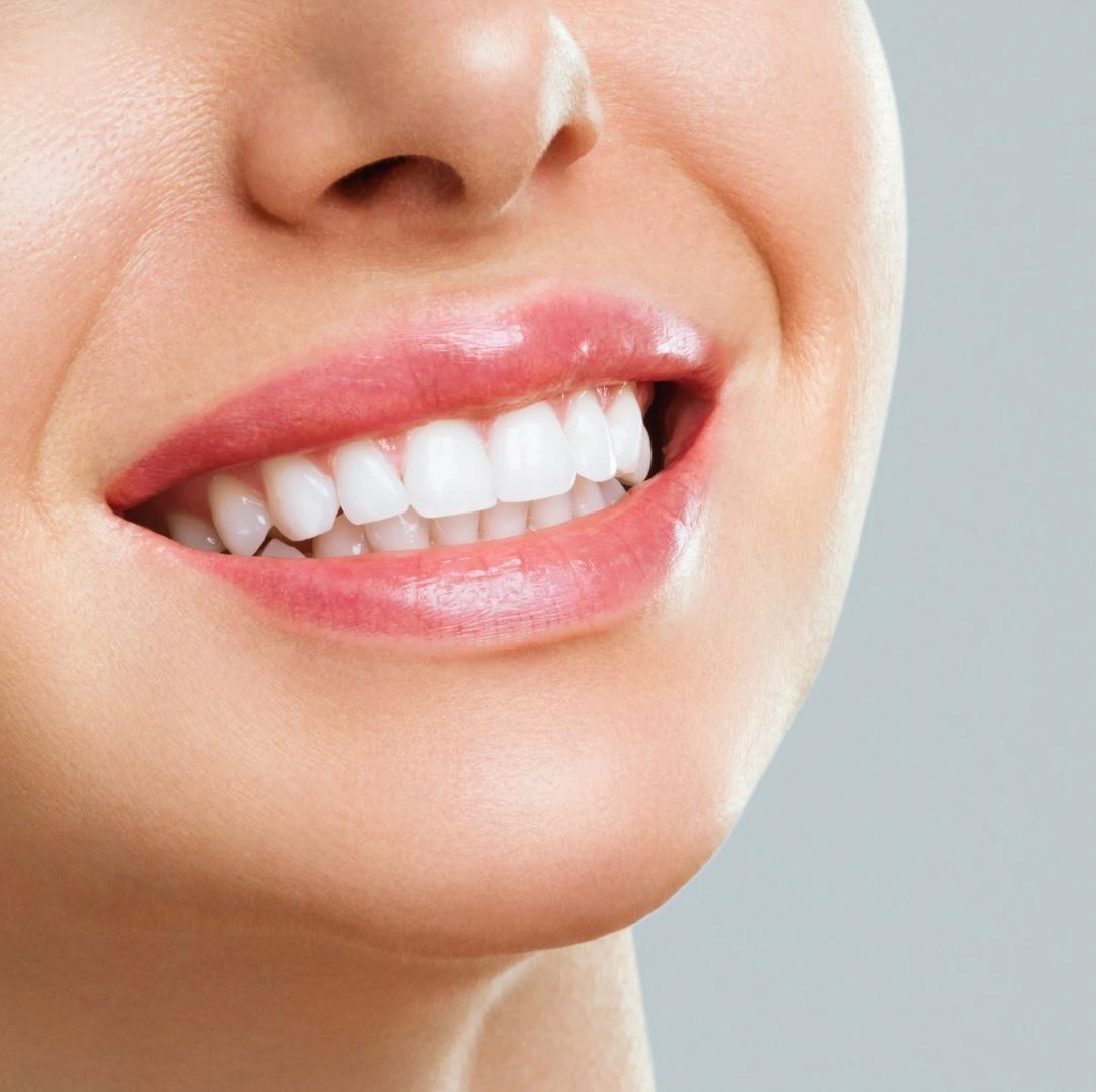 5 gestes quotidiens pour prévenir les caries